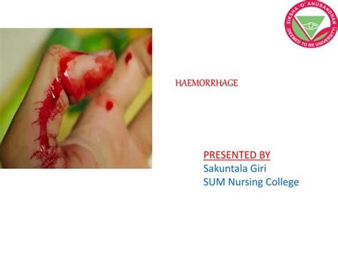 Haemorrhage | PPT