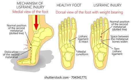 Nerve On Top Foot: Over 21 Royalty-Free Licensable Stock Illustrations ...