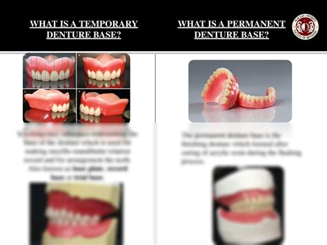 Solution Preparation Of Base Plate And Wax Rims In Complete Dentures