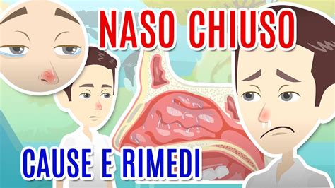 NASO CHIUSO Cause Diagnosi E Cure Per La CONGESTIONE NASALE YouTube