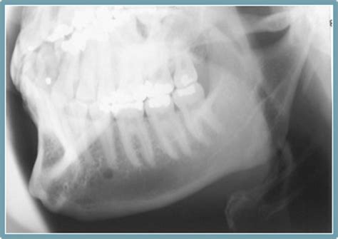 Extra Oral Radiography Flashcards Quizlet