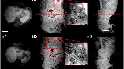 Phase-contrast X-ray imaging