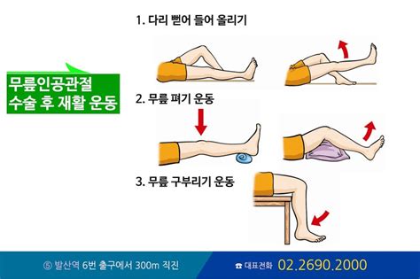 인공관절 수술 후 무릎 재활 모던블로그