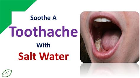 Home Remedies To Soothe A Toothache Stop Toothache With Salt Water