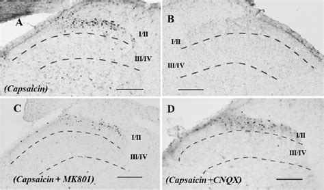 Photomicrographs Showing C Fos Positive Neurons In The Dorsal Horn Of