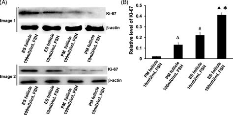 Cell Proliferation Of Follicular Granulosa By Assessing Ki