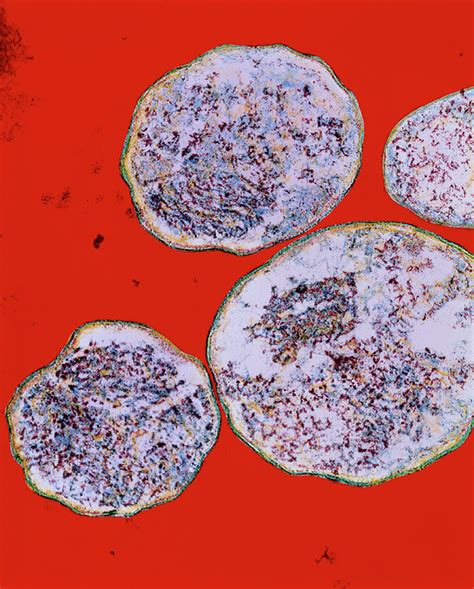 Chlamydia Trachomatis Bacteria Photograph By Dr Kari Lounatmaascience