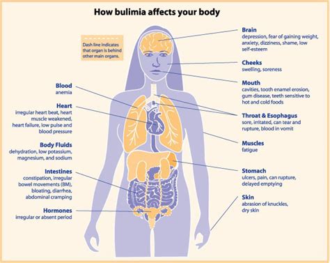 All About Disordered Eating Understanding And Addressing Eating