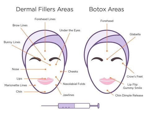 Botox Juvéderm Restylane Oh My Which Injectable Is Right For You