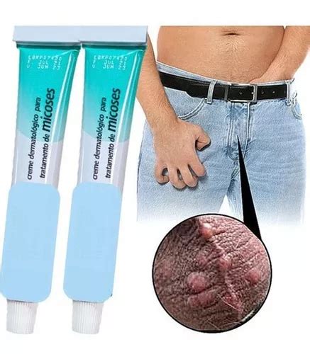 Pomada Ntima Candidiasis Masculina G Mercadolibre