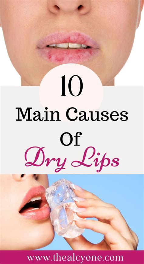 10 Reasons For Dry Cracked Lips And How To Heal It The Alcyone Dry