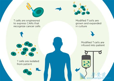 新型癌症免疫治疗方法cart细胞疗法存在一定的缺点 康安途海外医疗
