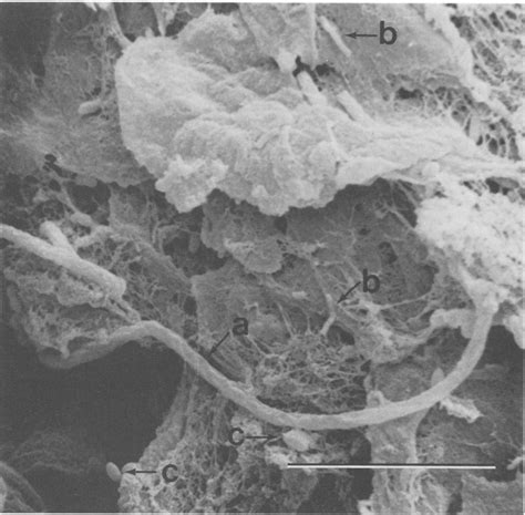 Scanning Electron Micrograph Of A Freeze Fractured Surface Of The Agar