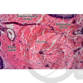 Man Sebaceous Gland Vertical Section 500X Sebaceous Gland