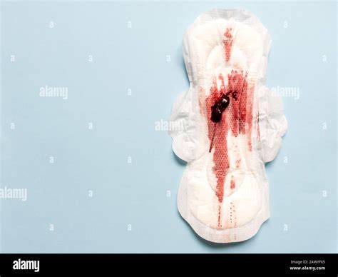 Endometriosis High Resolution Stock Photography and Images - Alamy