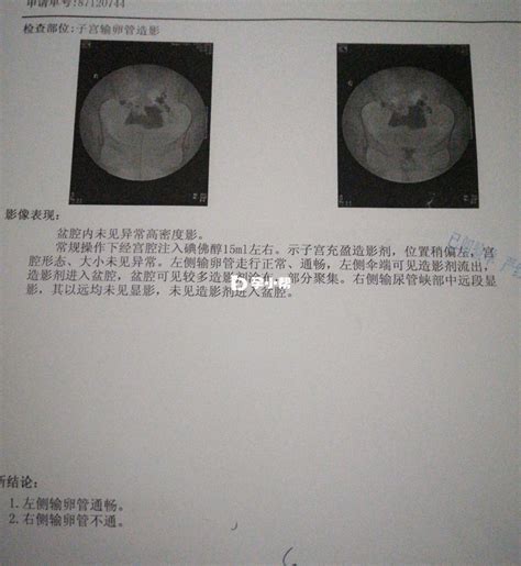 成功率究竟谁说了算，丽阳助孕中心能一次成功吗？ 孕小帮