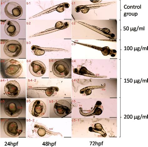 Representative Malformation Images Of Zebrafish For Different Time