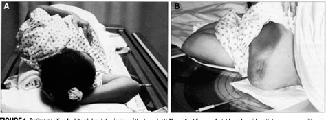 Figure From The Role Of Thallium Scintimammography With Lateral