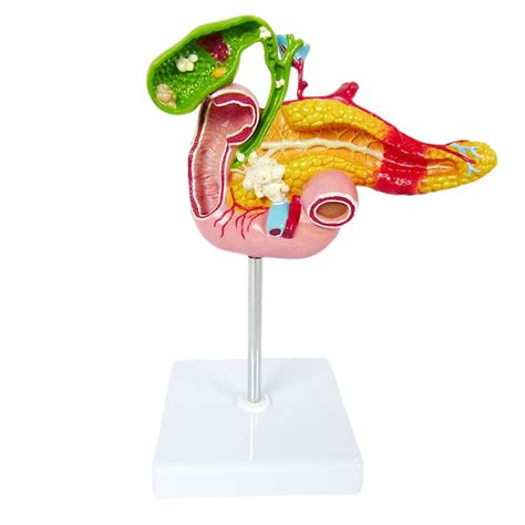 Buy BEAGHTY Pathological Model Of Pancreas Duodenum And Gallbladder