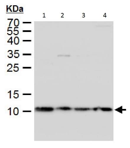 Anti-Sm-E antibody (ab229557) | Abcam