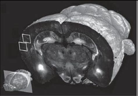 Whole Brain Mapping Technique Developed At Cshl