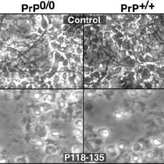 Neurotoxic Effects Of The Nonfibrillar Prp Fragment P On