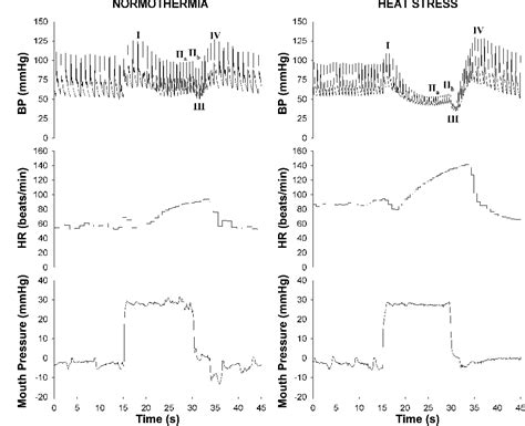 Figure 1 From Heat Stress Alters Hemodynamic Responses During The Valsalva Maneuver Semantic