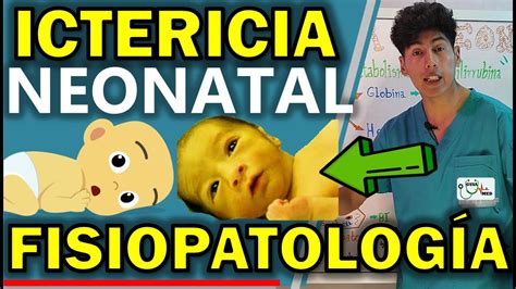 Ictericia Neonatal FisiopatologÍa Guiamed Youtube