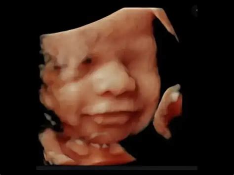 Whats The Difference Between 2d 3d 4d And 5d Ultrasounds