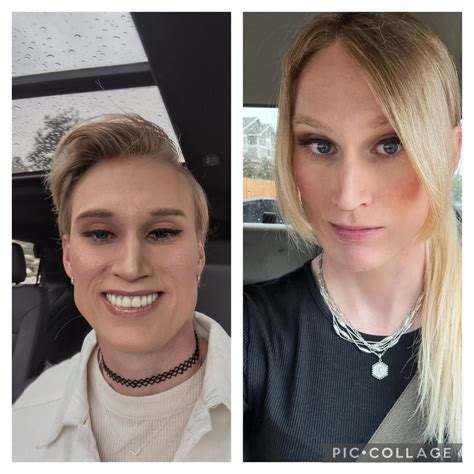 Left 12 Months Ago Right 14 Months Hrt I Think It S Working 😊 R Trans