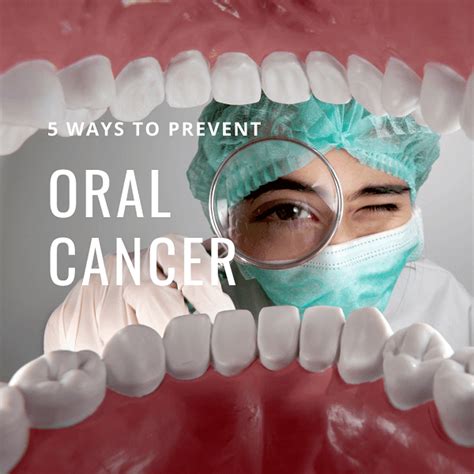 Is Oral Cancer Curable Risks Symptoms And Treatment Franklin