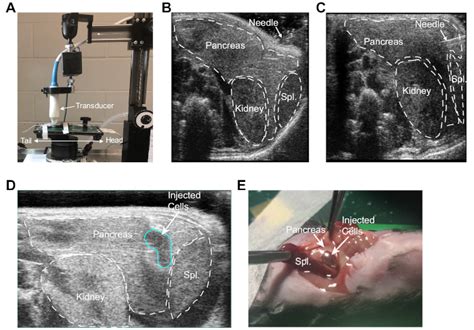 Ultrasound Guided Orthotopic Implantation Of Murine Pancreatic Ductal