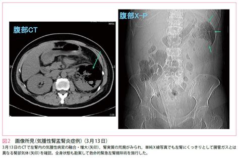 診断のための検査法 尿路感染症診断のための培養と画像検査 M Review