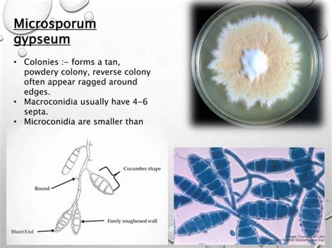 Microsporum fungi. | PPT