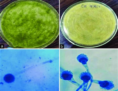 Culture And Microscopic View Of The Aspergillus Fumigatus A View Of