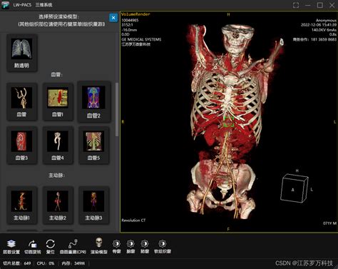 C 开发PACS医学影像三维重建 一 使用VTK重建3D影像 c vtk CSDN博客