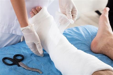 Having an arm or leg cast can be unbearable. Here are 10 helpful cast care tips to relieve your ...