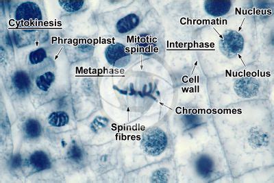 Metaphase Microscope