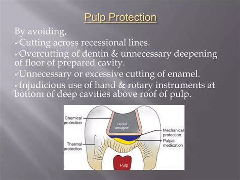 Principles Of Cavity Preparation Ppt