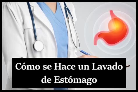 Cómo Se Hace Un Lavado De Estómago ¿ Cómo Se Hace