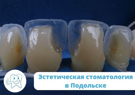 Эстетическая стоматология в Подольске: возможности и тенденции ...