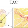 Gn Improves Cardiac Function And Reduces Myocardial Fibrosis After Tac