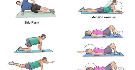 Cervical Disc Herniation Exercises