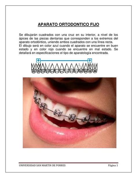 REGLAS DEL ODONTOGRAMA SALUD PREVENTIVA Douglass Dr Douglassjaime