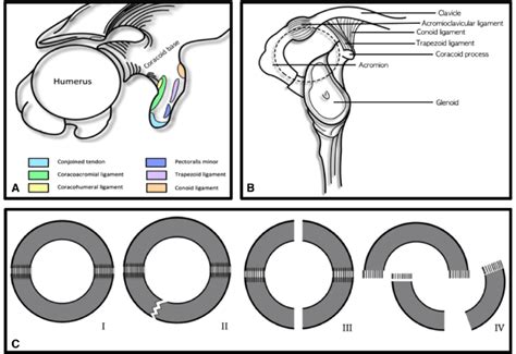 A The Coracoid Process And Its Attached Anatomical Structures Superior