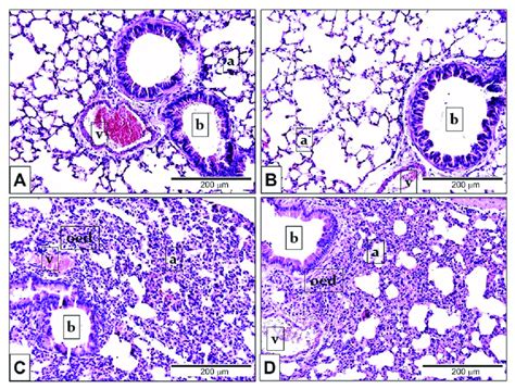 Representative Histological Pictures Of Lps Induced Pulmonary Download Scientific Diagram