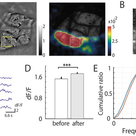 Two Photon Calcium Imaging Of Ic Spontaneous Neuronal Activities In The