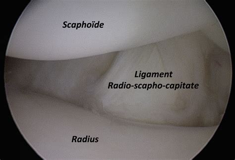 Anatomie Du Poignet Et De La Main Clinique Ost O Articulaire Des