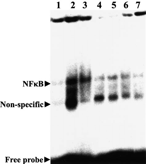 Ketamine Reduces Nf B Activation And Tnf Production In Rat Mononuclear