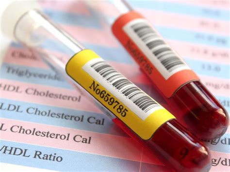 Hdl Blood Test Results Explained Infoupdate Org